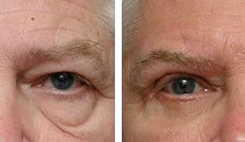 Eye cream, Natural Polymer formula, 15ml.